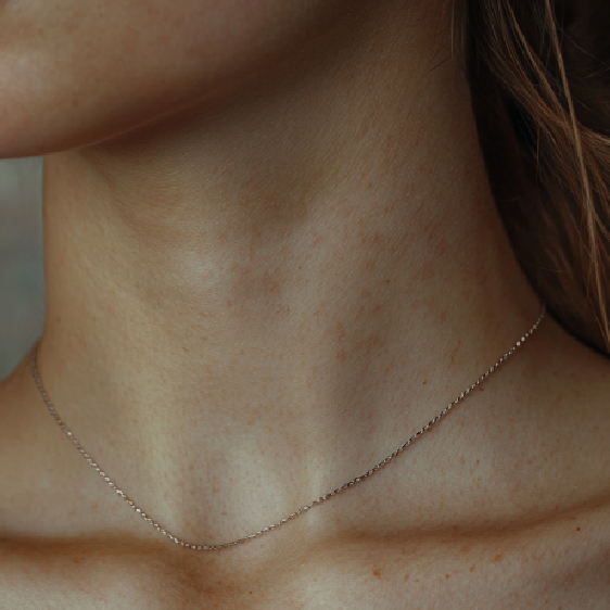 Neck Wrinkles: Why They Happen & How to Get Rid of Them